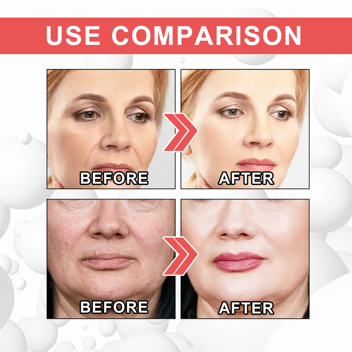 REVERSE Recombination Wrinkle Lift Cream Zera