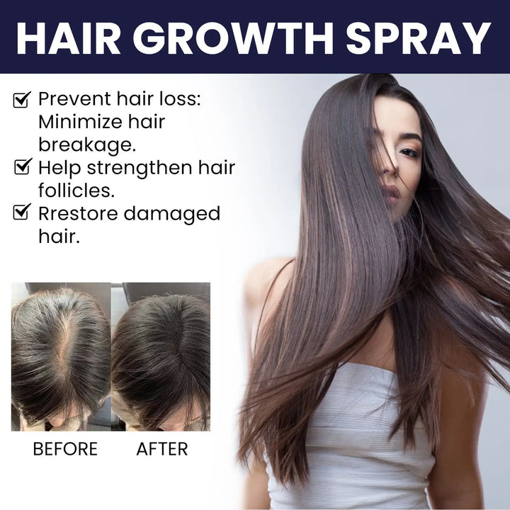 Hair Growth Spray Moisturizes Damaged Hair Zera