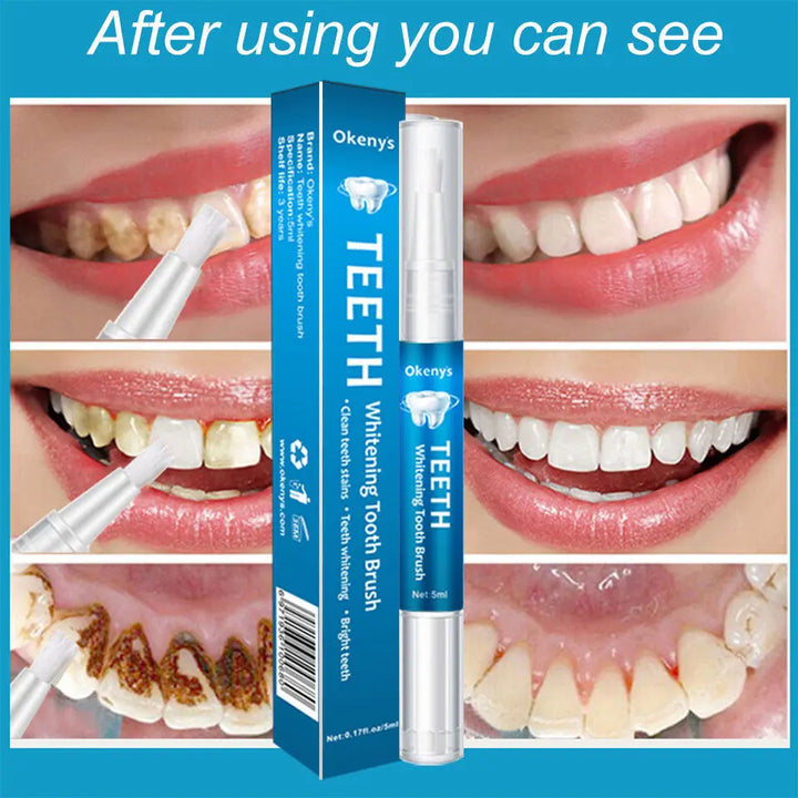 Teeth Whitening Pen Care Powerful Removal Of Yellow - BEAUTIRON