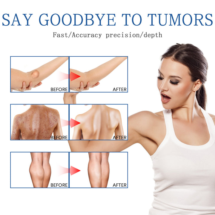 Relief Of Body Fat Lump, Subcutaneous Fat Nodule, Dredging Spray Zera