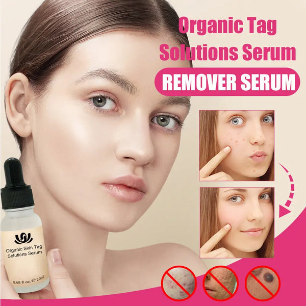 Organic Tags Solutions Serum No Trace Painle Skin Tag Remover Serum Mole Removal Cream Painless Face Wart Mole Freckle - BEAUTIRON