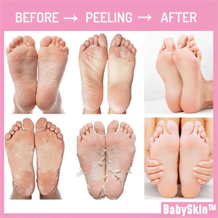 Spa-Like Treatment at Home with BabySkin