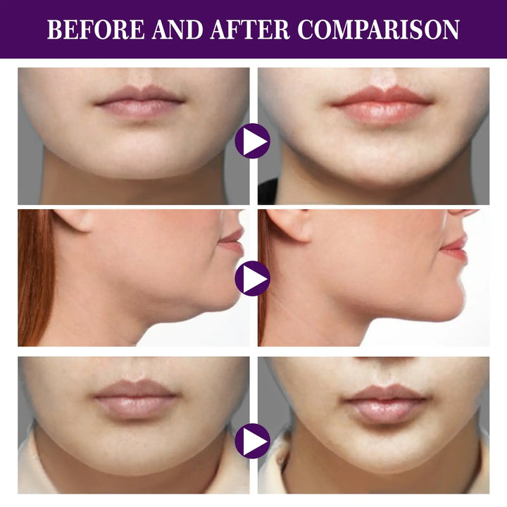 Facial Tightening Double Chin Invisible Lifting Sticker - BEAUTIRON