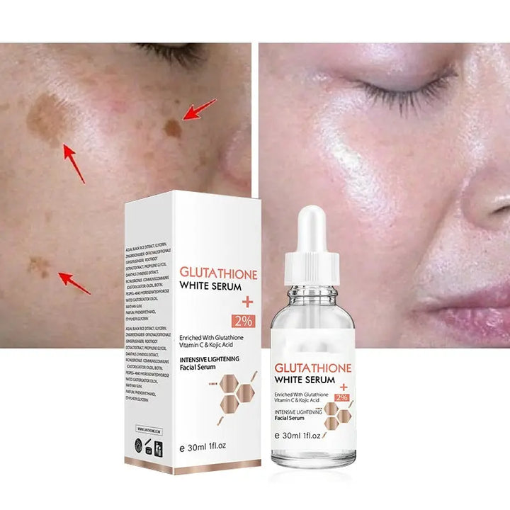 Discoloration Improvement Brightening And Whitening Skin Color - BEAUTIRON