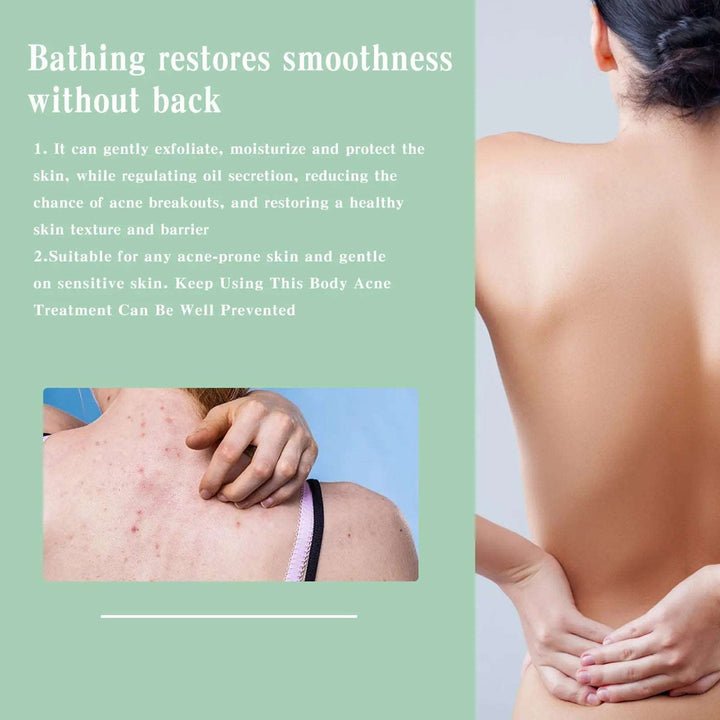 Back Acne Repair Back Shoulder Acne Desalination Acne Mark Skin Care Spray - BEAUTIRON