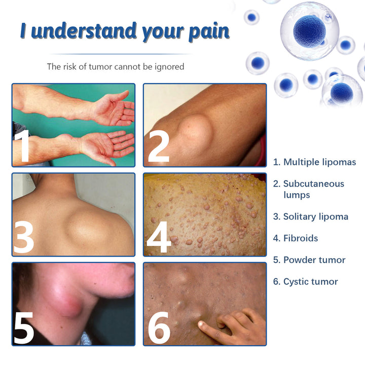 Relief Of Body Fat Lump, Subcutaneous Fat Nodule, Dredging Spray Zera