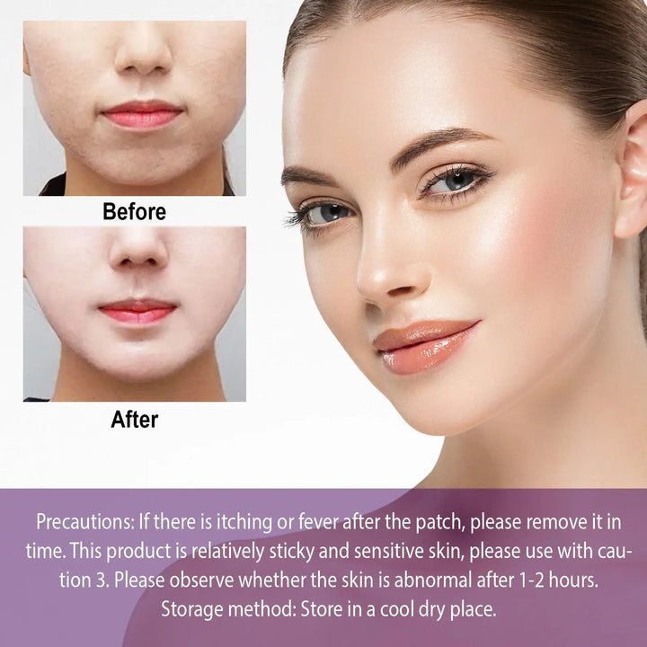 Facial Tightening Double Chin Invisible Lifting Sticker - BEAUTIRON