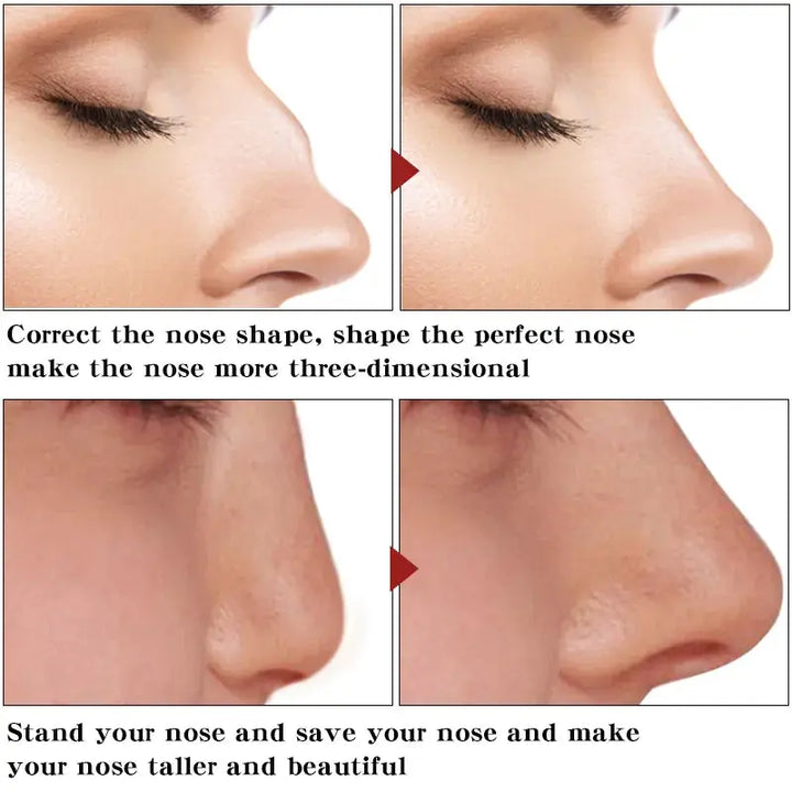 Nose Up Heighten Rhinoplasty Oil 30ml Nose Up Heighten Rhinoplasty Nasal Bone Remodeling Pure Natural Care Thin Smaller Nose - BEAUTIRON