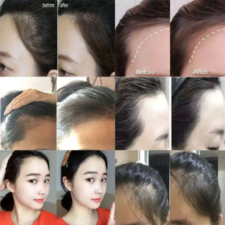 1PC Hairline Repair Filling Powder With Puff Sevich Fluffy Thin Powder Pang Line Shadow Powder Forehead Hair Makeup Concealer - BEAUTIRON