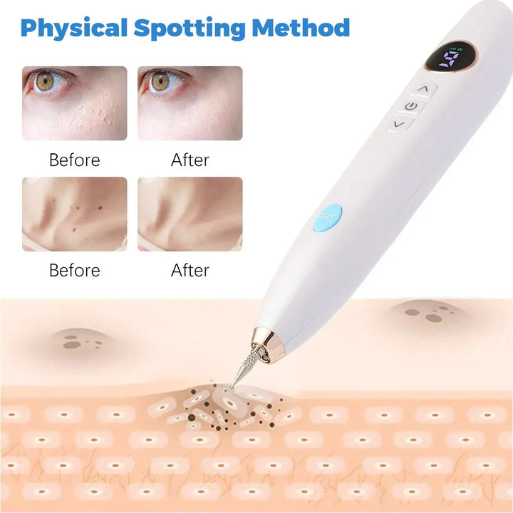 Mole Spot Scanning Pen Needle Light LED Screen 9-speed Tattoo Removal Plasma Pen Beauty Instrument - BEAUTIRON