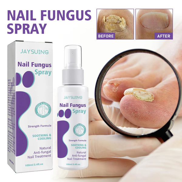 Onychomycosis Repair Spray Nail Fungus Treatment Hand Foot Soft Nail Ingrowing Thickening Nail Cleaning Care Hongos Uñas Pies