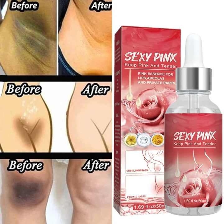 Pink Sexy Women Essence For Lip Areolas Private Parts Tender Remove Intimate Melanin Skin Care Whitening Dark Spot Body Serum BEAUTIRON