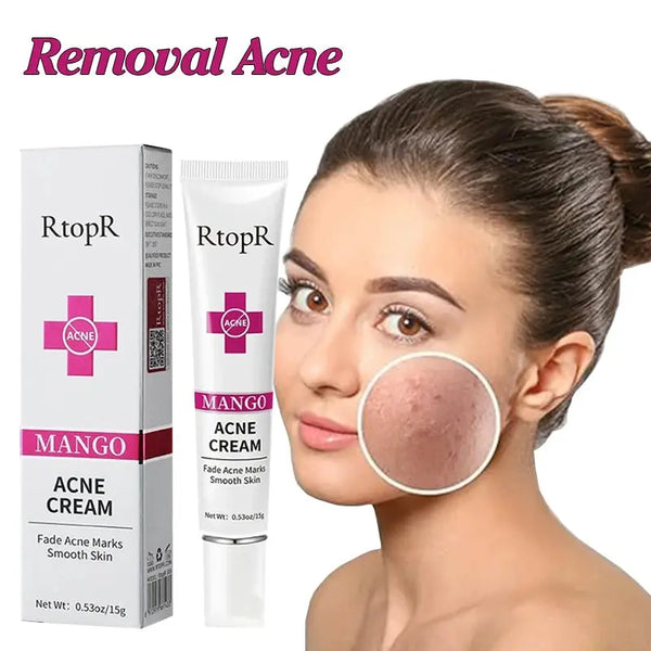 Acne Cream Acne Mark Removal Acne Mild Repair Damaged Skin Hydration Nourishment Rejuvenation Skin Brightening Skin Care - BEAUTIRON