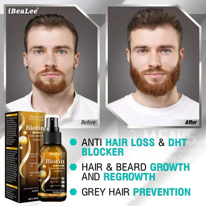 Hair Growth Products Biotin Anti Hair Loss Spray Scalp Treatment Fast Growing Care Essential Oils for Men Women Hair Care - BEAUTIRON