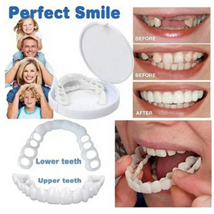 Snap-On Silicone Smile Veneers for Confidence - BEAUTIRON