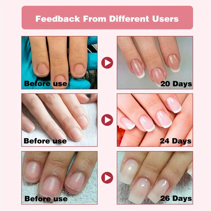 KODIES GEL Nail Strengthener Growth Restore Hardener Clear Nail Polish Base Coat Fast Dry 15ML Strong Repair Nail Art Treatment - BEAUTIRON