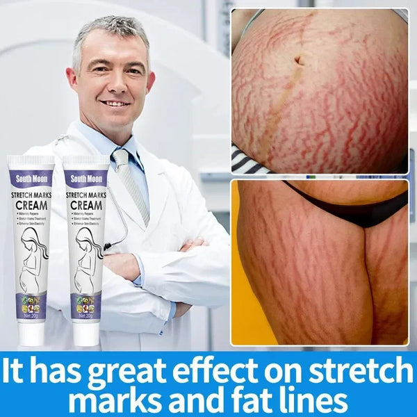 Stretch Mark Permanent Remover Stretch Mark Removal Cream White Stretch Mark Remover Stretch Mark Remover Free Shipping