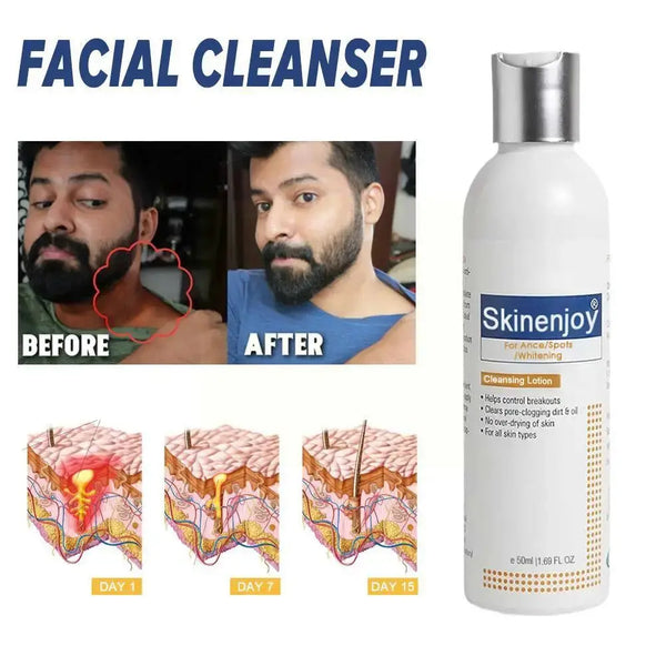 Skinenjoy Whitening Facial Cleanser Brighten Skin Tone Whitening Face Removal Smooth Fade Refreshing Wash Cleaning Foam Chl E1S8 - BEAUTIRON