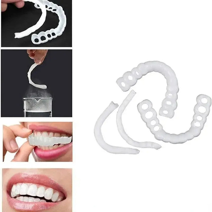 Snap-On Silicone Smile Veneers for Confidence - BEAUTIRON