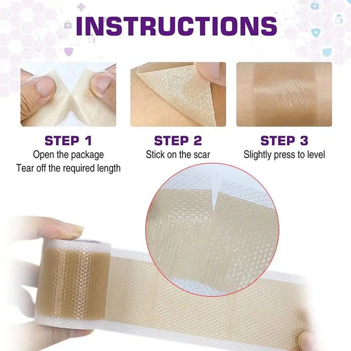 Silicone Scars Sheets Keloid Bump Removal Strips, Scars Reducing Treatments Surgical Scars, Burn,Tummy Tucks, Acne, C-Section - BEAUTIRON