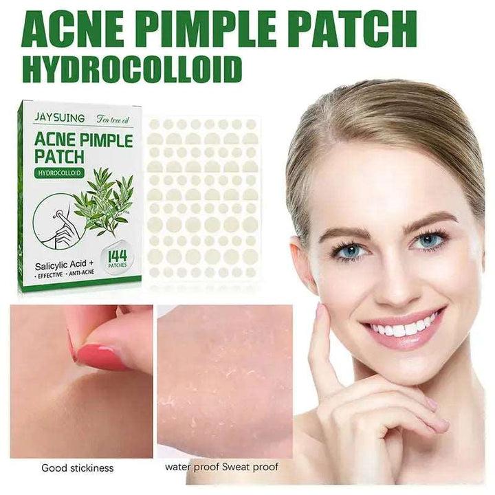 144 Patches Acne Pimple Patch Face Invisible Stickers Quick Effect Treatment Removing Patches Beauty Acne Tools Face Skin Care - BEAUTIRON