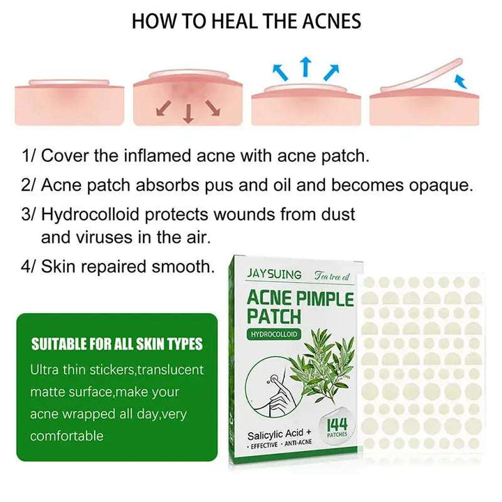 144 Patches Acne Pimple Patch Face Invisible Stickers Quick Effect Treatment Removing Patches Beauty Acne Tools Face Skin Care - BEAUTIRON