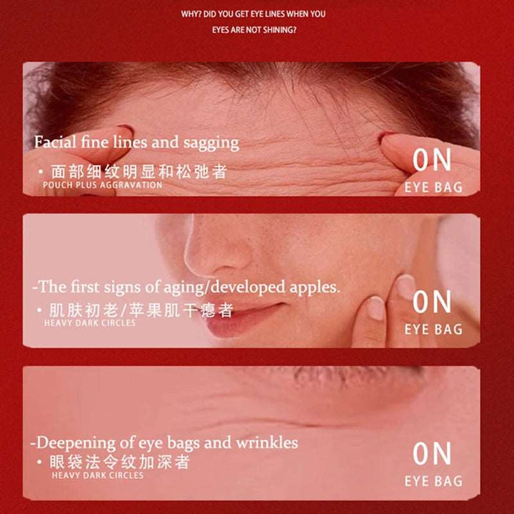 1 box Active Repair Facial Type III Collagen Lyophilis Powder Set Anti-Aging Wrinkle Hyaluronic Acid Moisturis Whiten Skincareca