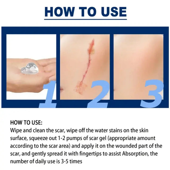 100% Silicone Scar Removal Cream Gel Burn Surgical Scar Cesarean Scar Repairing Stretch Marks Whitening Pigmentation Corrector - BEAUTIRON