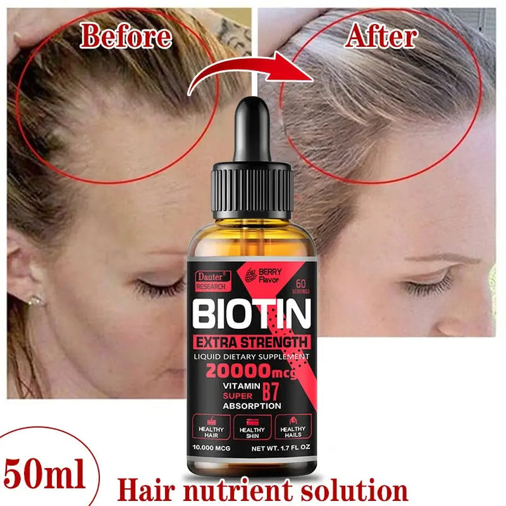 Fast Hair Growth Oil Hair Regeneration Essence Hair Thinning Treatment Hair Growth Fluid Anti-Hair Loss Care for Men and Women - BEAUTIRON