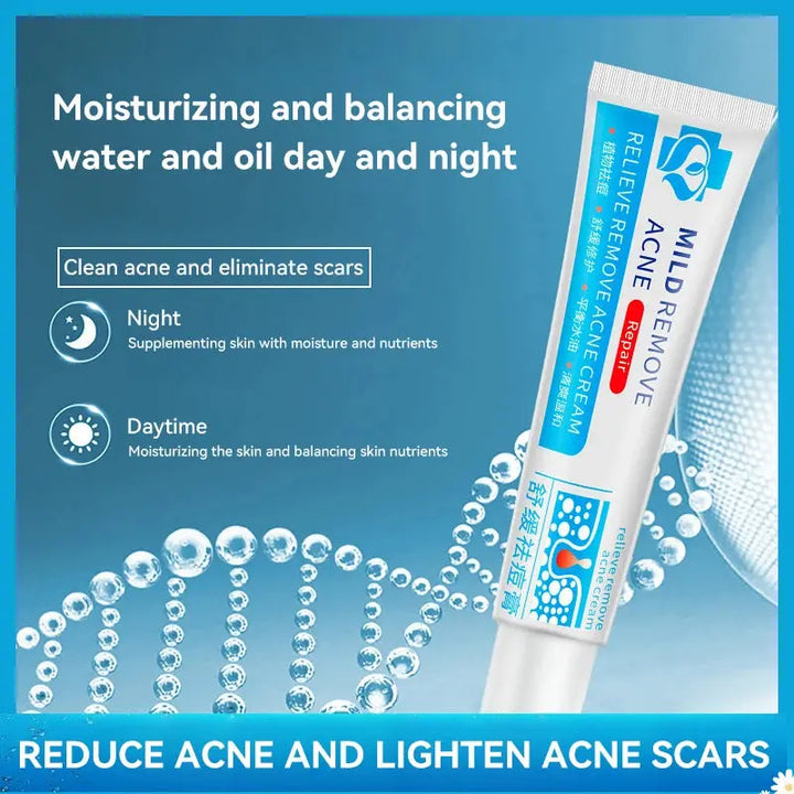 Salicylic Acid Acne Treatment Cream Shrinking Anti-acne Oil Deep Cleaning Pore Repair Pimple Spots Control Moisturizer Skin Care - BEAUTIRON