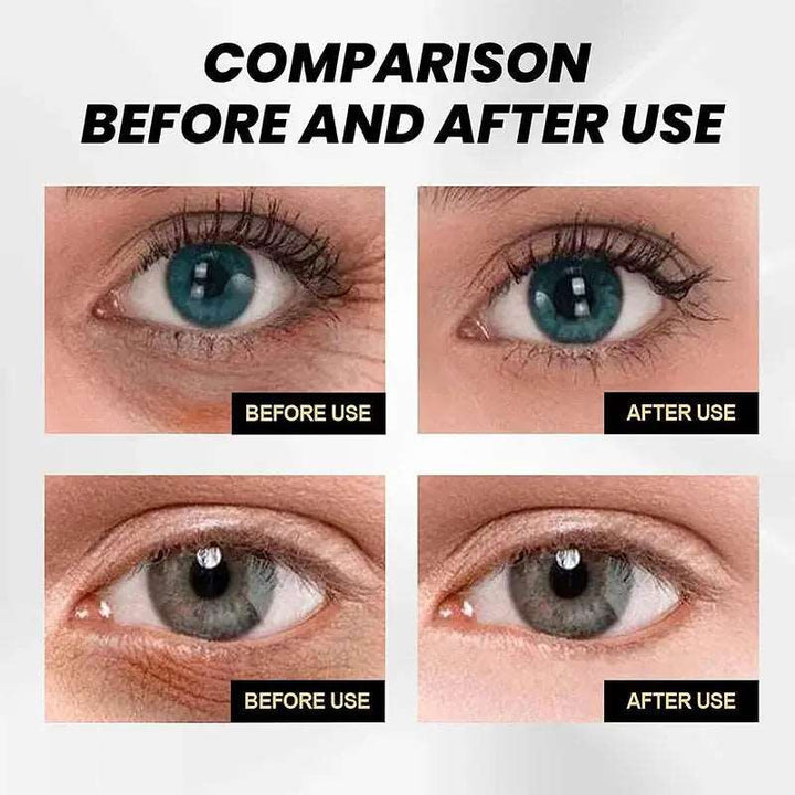 30ml CËLYN Instant Firm Eye Cream Eye Lifting Eye Bag Removal Wrinkle Removal Dark Circle Remover Eyes Skin Beauty Care - BEAUTIRON