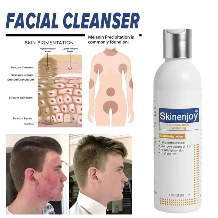 Skinenjoy Whitening Facial Cleanser Brighten Skin Tone Whitening Face Removal Smooth Fade Refreshing Wash Cleaning Foam Chl E1S8 - BEAUTIRON