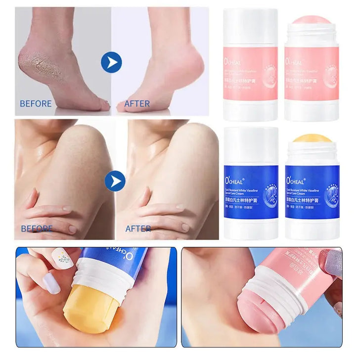 40g Anti-Drying Crack Foot Cream Nourishing Hand Cracked Repair Mositurizing Cream Removal Dead Skin Hand Feet Care Skin - BEAUTIRON