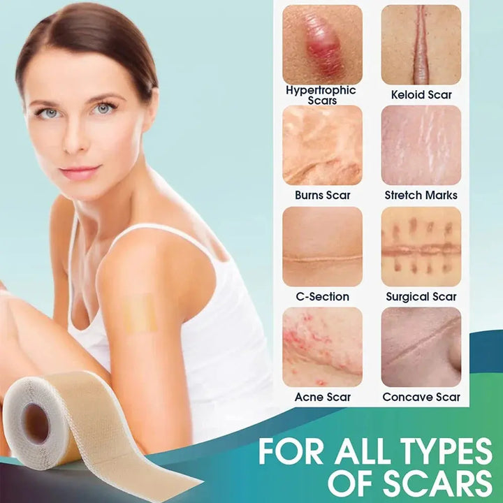 Silicone Scars Sheets Keloid Bump Removal Strips, Scars Reducing Treatments Surgical Scars, Burn,Tummy Tucks, Acne, C-Section - BEAUTIRON