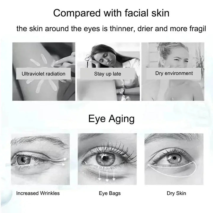 Nicotinamide Eyes Cream Dark Circles Remove Eye Bags Under Eye Hyaluronic Acid Moisturizing Serum Against Puffiness Eye Care Gel - BEAUTIRON