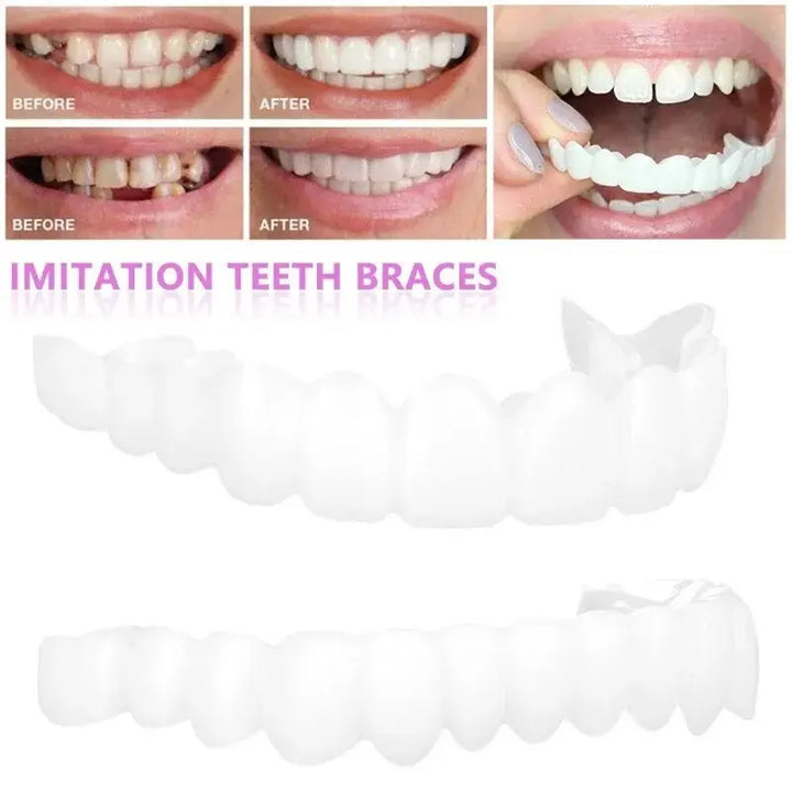 Snap-On Silicone Smile Veneers for Confidence - BEAUTIRON