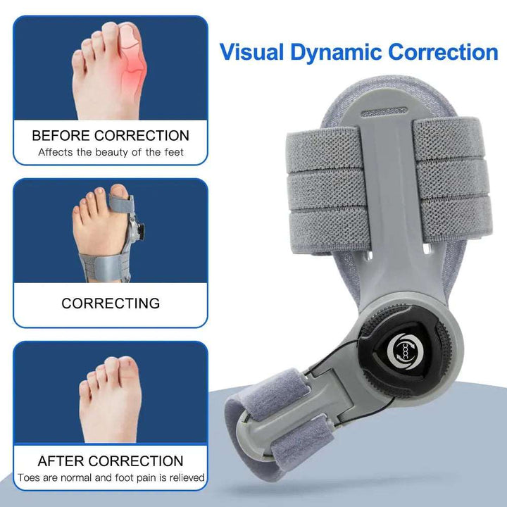 Bunion Corrector Unisex Foot Hallux Valgus Braces Rotatable Toe Separator Straightener Adjustable Pedicure Finger Toe Corrector - BEAUTIRON