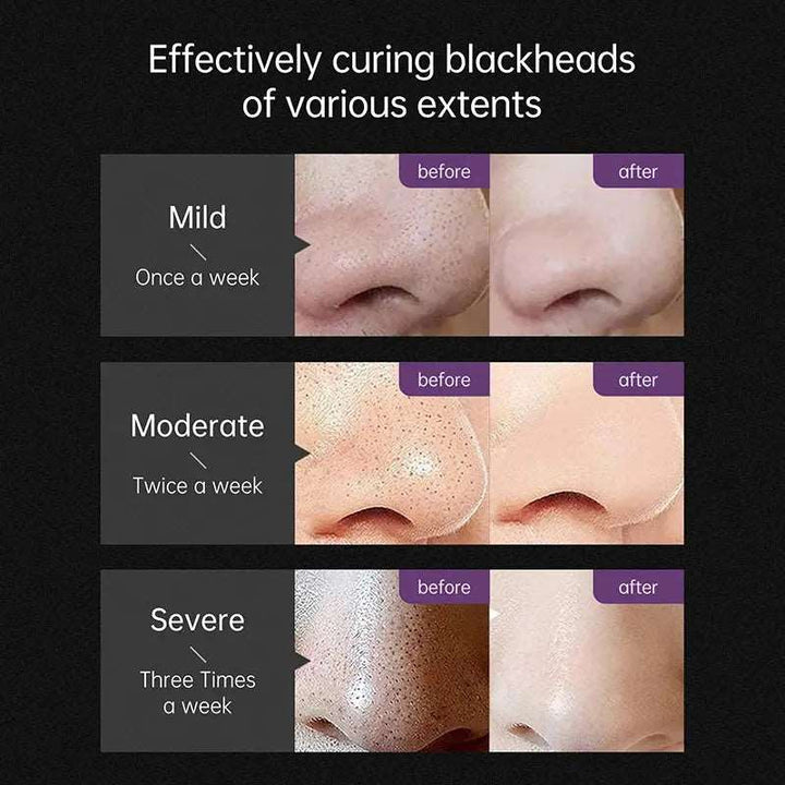 AUQUEST Blackhead Remover Black Dots Facial Masks NoseBamboo Charcoal Point Pimple Anti Acne Spot Face Skin Care Beauty Health - BEAUTIRON