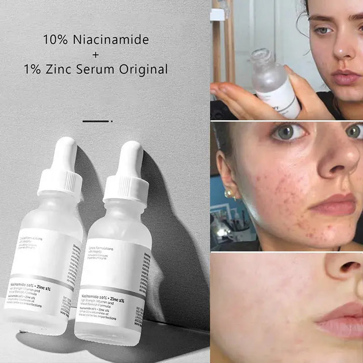 Original Niacinamide 10% + Zinc 1% B5 Essence Fruit Acid 30% Salicylic Caffeine Vitamin Moisturizes Tightens Soften Skin Care - BEAUTIRON