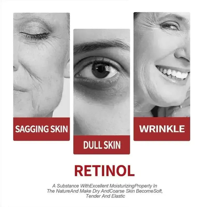 Retinol Wrinkle Removing Cream Lifting Anti Aging Firming Fade Fine Lines Whitening Brightening Moisturizing Skin Care Cosmetic - BEAUTIRON