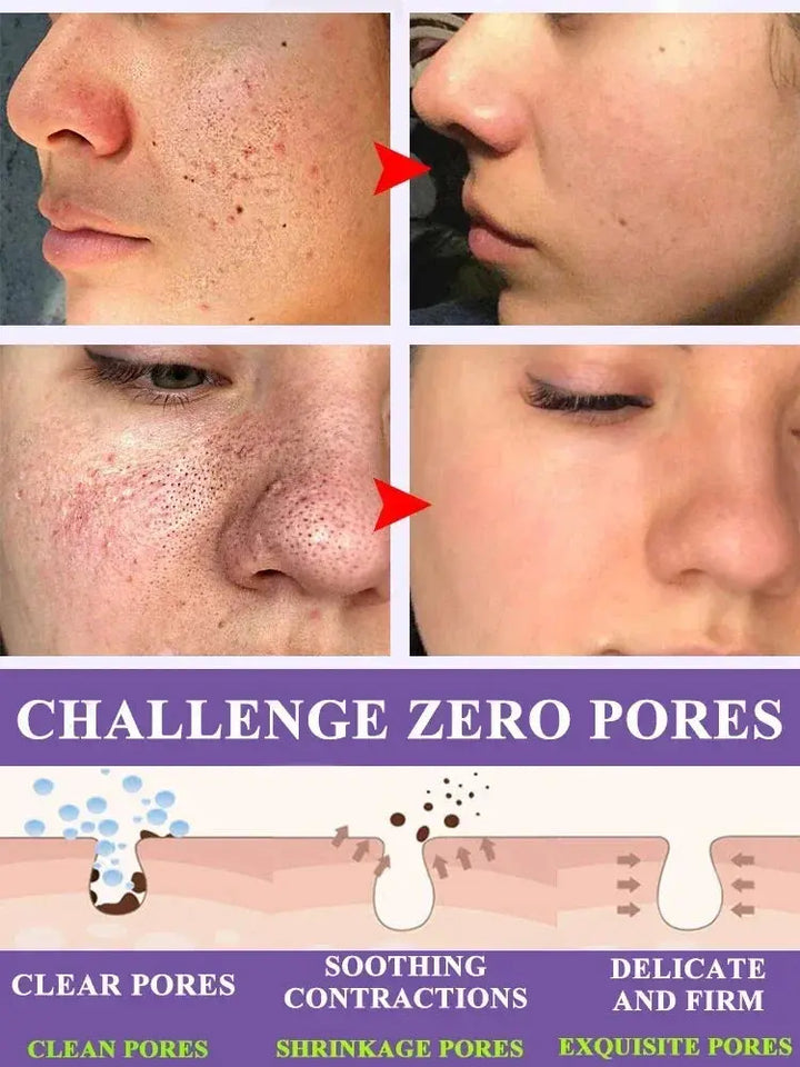 Pores Remover Pore Shrinking Serum Shrink Tightening Minimizing - BEAUTIRON