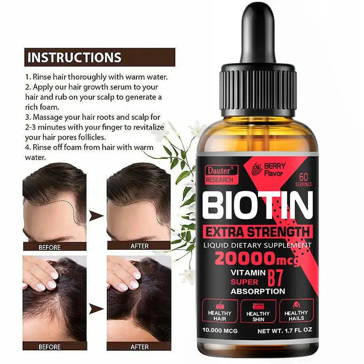 Fast Hair Growth Oil Hair Regeneration Essence Hair Thinning Treatment Hair Growth Fluid Anti-Hair Loss Care for Men and Women - BEAUTIRON