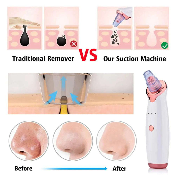 Blackhead Remover Skin Care Face Clean Pore Vacuum Acne Pimple Removal Suction Facial Diamond Dermabrasion Tool Care - BEAUTIRON