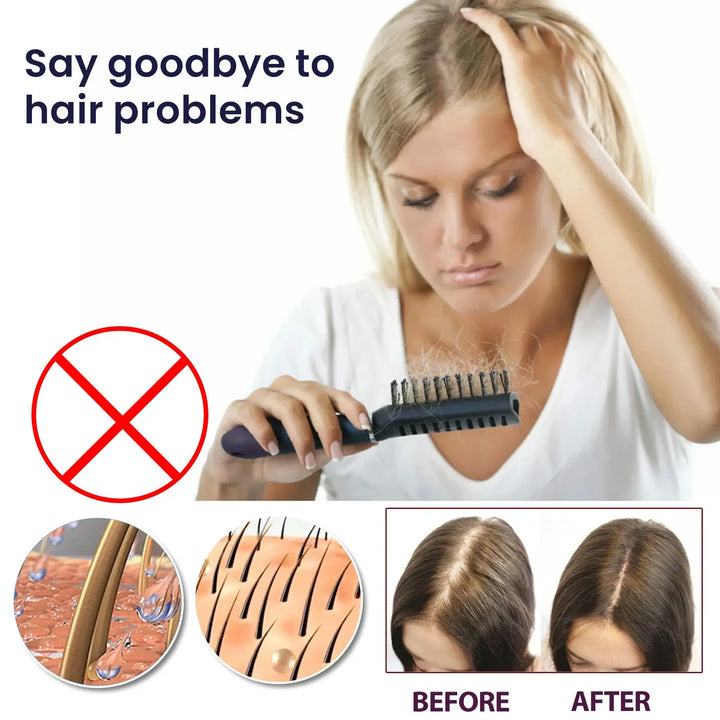 Hair Growth Spray Moisturizes Damaged Hair Zera