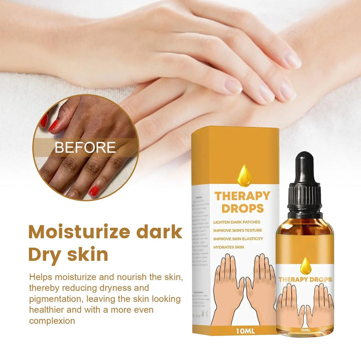 Knuckle Black Acanthosis Hand Joint Skin Melanin Fading Brightening - BEAUTIRON