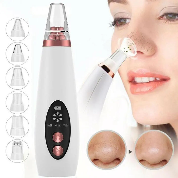 Adjustable Suction Levels for Customized Skincare