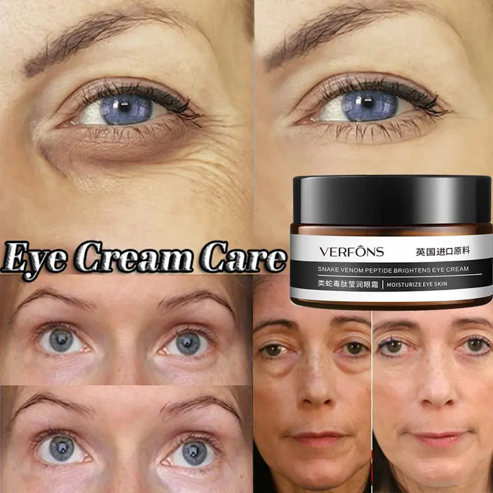 Firming Eye Cream Moisturizing Eye Cream Women's Fine Line Dark Circle Remover Moisturizing Essence Eye Mask Cream - Zera