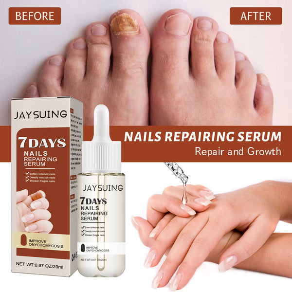 Repair Inlay Nail Thickening Type Dust Hand And Foot Nail Repair