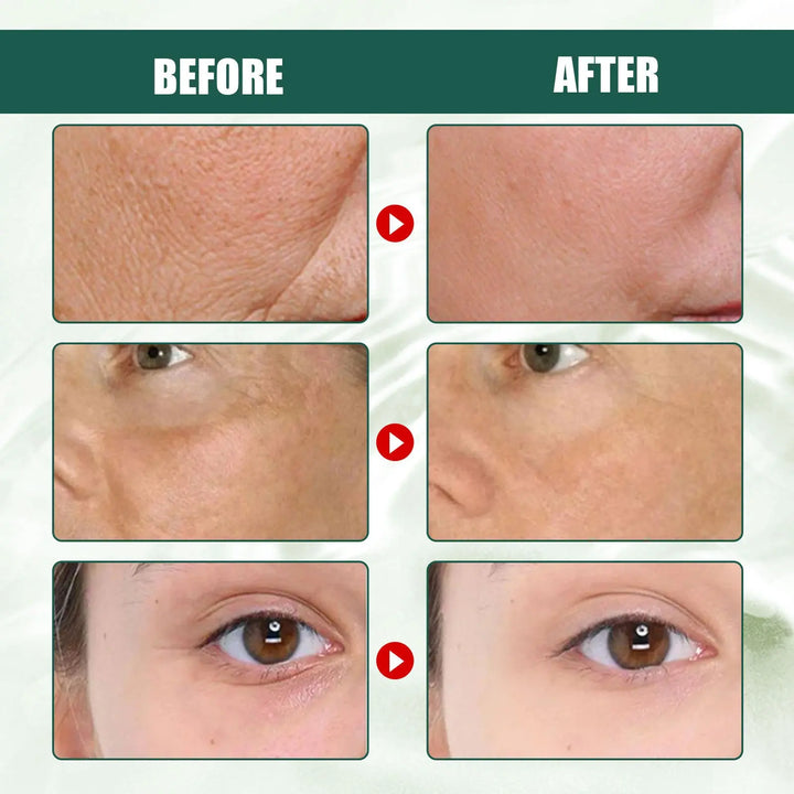 Intensive Anti-wrinkle Fade Fine Lines And Dark Circles Adjust Skin Tone Tighten And Moisturize Skin Care Zera