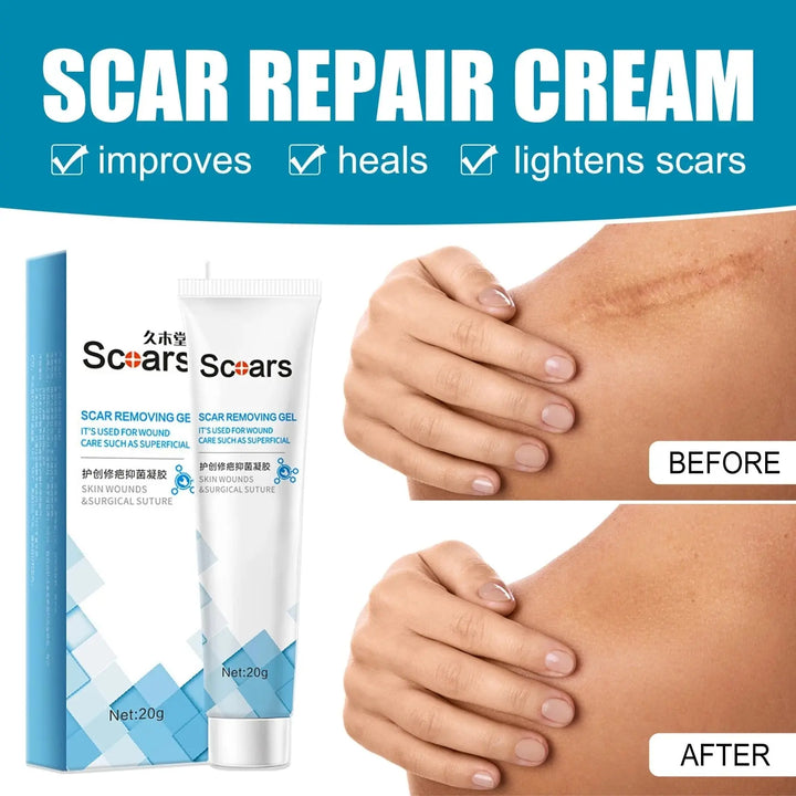 New Herbal Scar Repair Cream - Zera